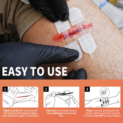 QuickSeal™ ZipStitch Pro – 6pc Wound Closure Set