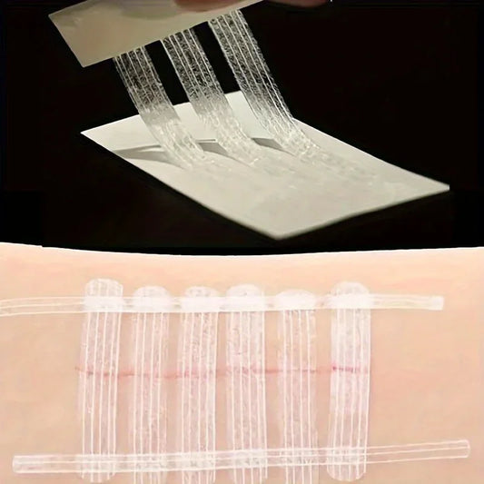 QuickSeal™ Wound Closure Strip Lite